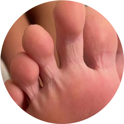 Close-up of a person's healthy toes and skin